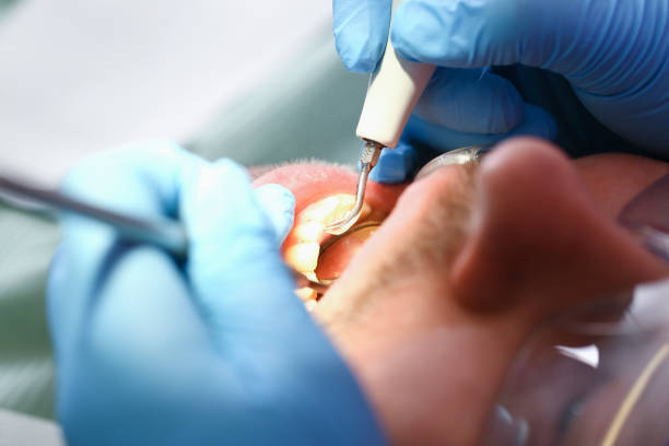 Best Emergency Orthodontic Services in Lovington, IL