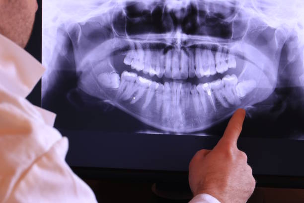 Best Urgent Care for Lost Fillings or Crowns in Lovington, IL