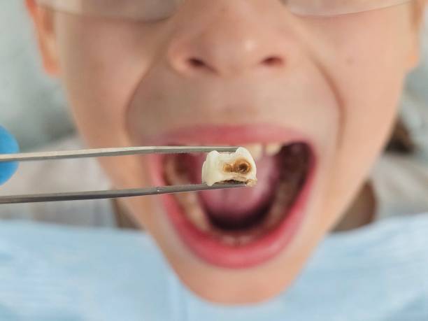 Best Weekend Emergency Dentist in Lovington, IL