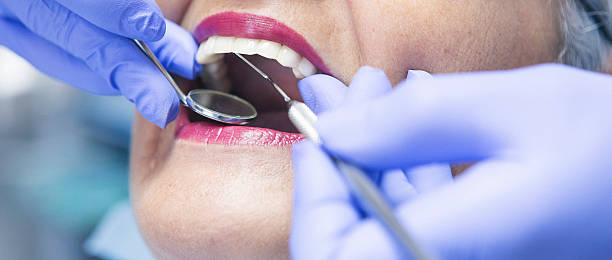 Best Emergency Treatment for Dental Infections or Abscesses in Lovington, IL